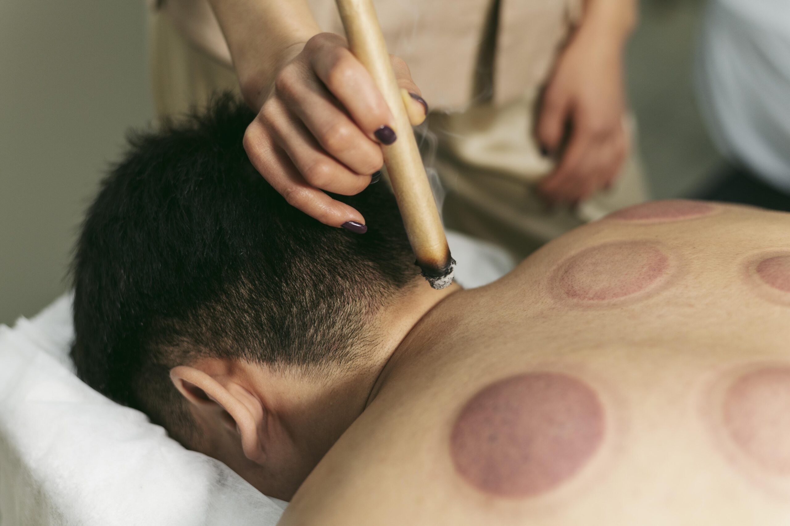 sessao-de-terapia-de-ventosas-de-perto